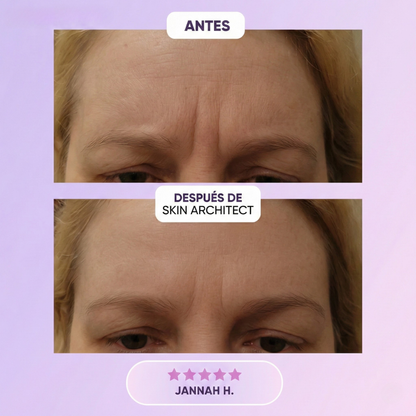 Skin Architect™ Láminas de Silicona y Colágeno